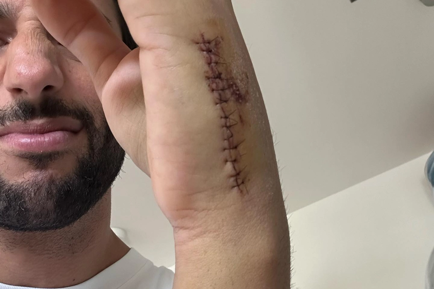 En convalescence, Daniel Ricciardo est tout de même présent à Singapour